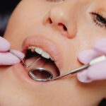 Close-up of a woman's dental checkup with a dentist using tools in a clinic.